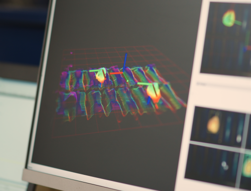 Artificial intelligence software